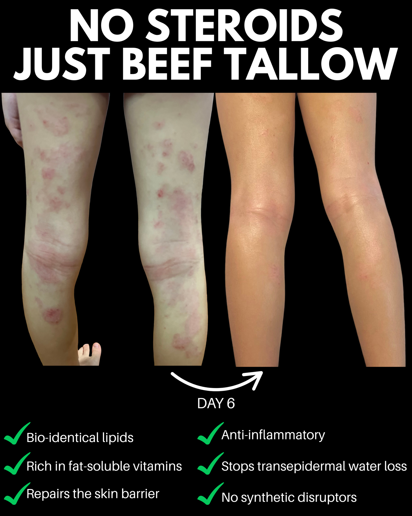 Pure Tallow Glow: 100% Beef Tallow Moisturiser
